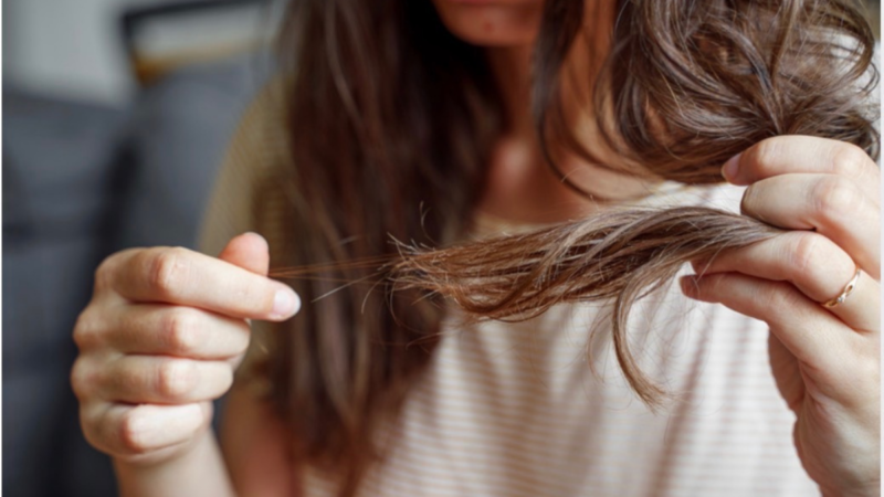Mengapa Semua Orang Berbicara Tentang Rambut Rontok?
 | beritakitanih