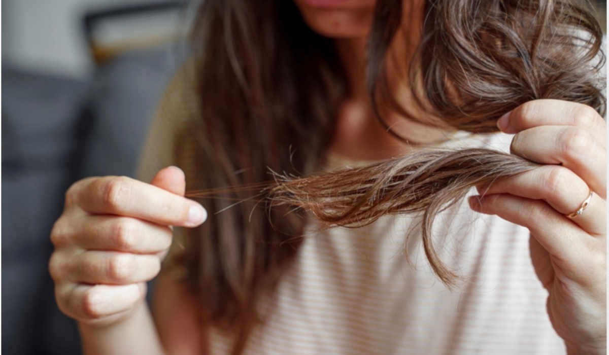 Mengapa Semua Orang Berbicara Tentang Rambut Rontok?
 | beritakitanih